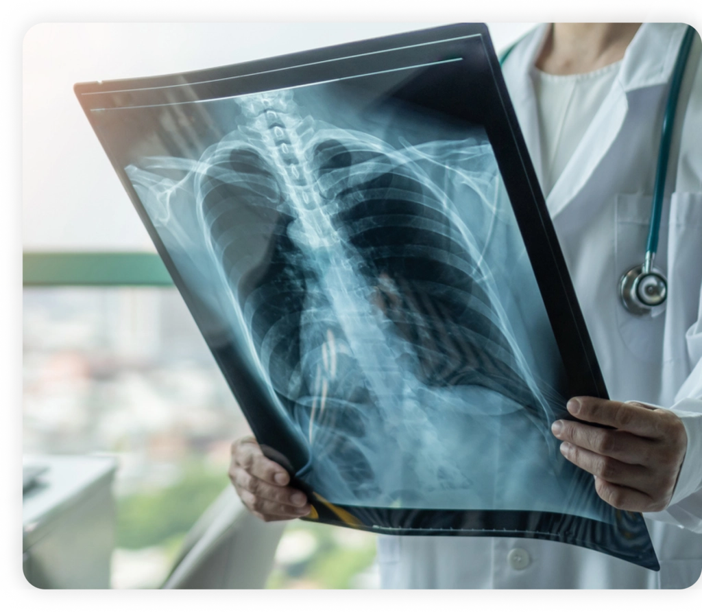 DIGITAL XRAY
