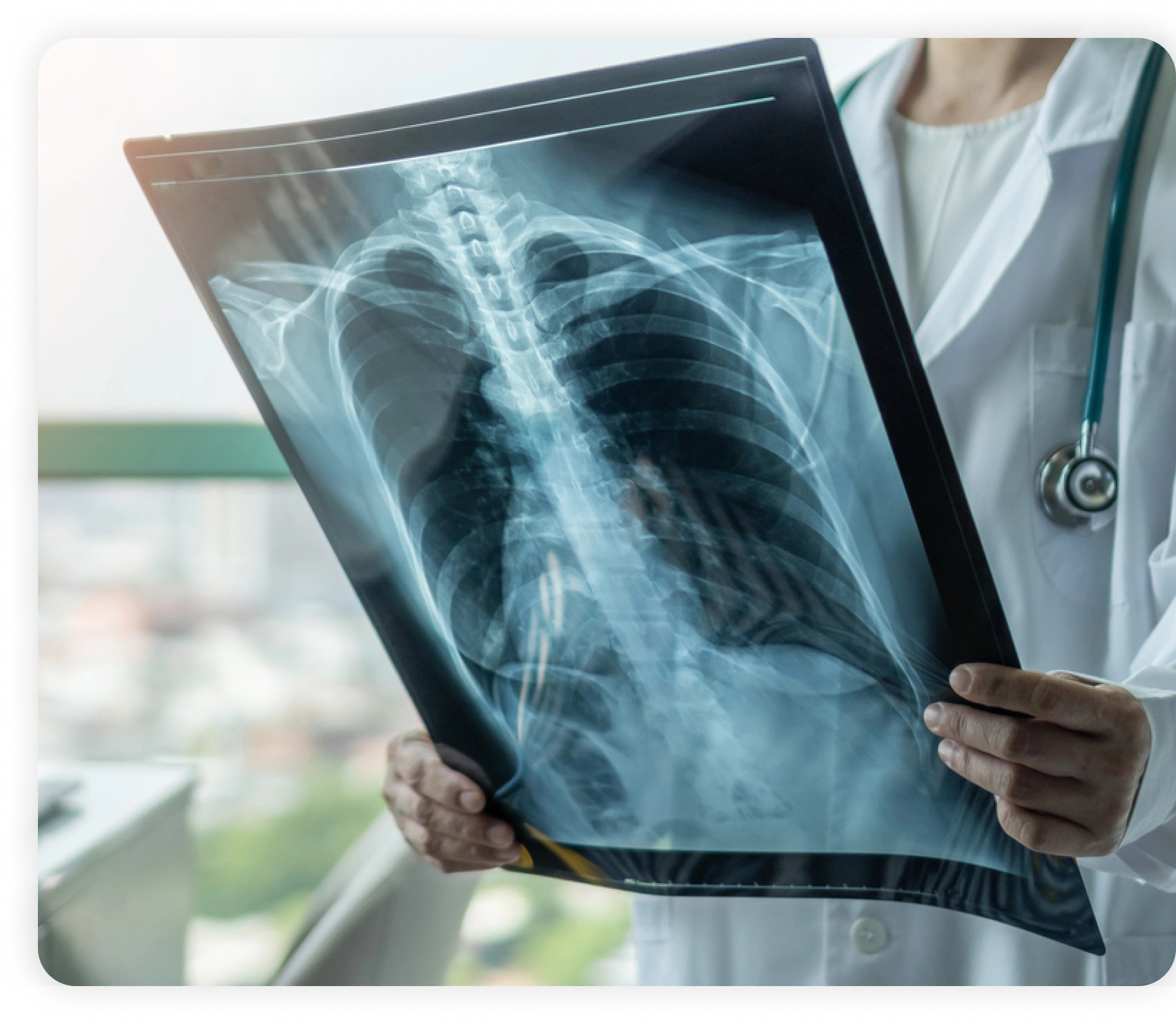 DIGITAL XRAY