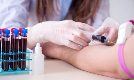 Why Regular Blood Tests Are Essential: Benefits of Pathology Services